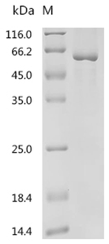 Recombinant Human Transforming growth factor beta regulator 1 (TBRG1)