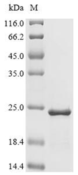 Recombinant Human Tubulin-specific chaperone A (TBCA)