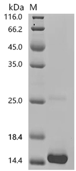 Recombinant Human Somatostatin (SST), partial