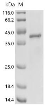 Recombinant Human Ribonuclease H1 (RNASEH1) (D210N)