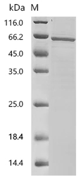 Recombinant Mouse Serine/threonine-protein phosphatase 2B catalytic subunit beta isoform(Ppp3cb)