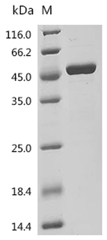 Recombinant Human DNA polymerase beta (POLB)