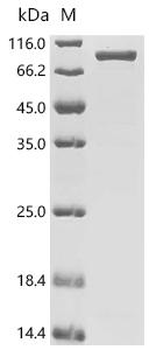 Recombinant Mycobacterium ulcerans Ornithine carbamoyltransferase (argF), Biotinylated