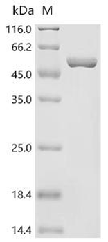 Recombinant Human Ornithine aminotransferase, mitochondrial (OAT)