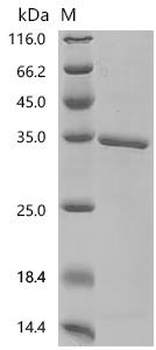 Recombinant Human Glucocorticoid receptor (NR3C1), partial