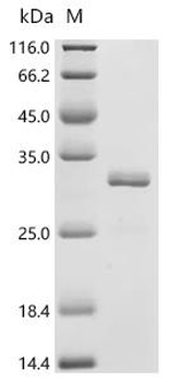 Recombinant Mouse Nitric oxide synthase, endothelial (Nos3), partial