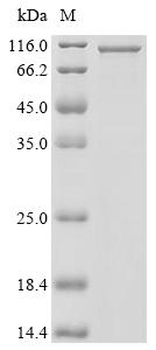 Recombinant Human Muscle, skeletal receptor tyrosine-protein kinase (MUSK), partial, Biotinylated