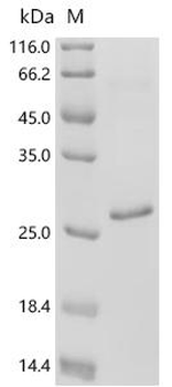 Recombinant Human Rhombotin-1 (LMO1)