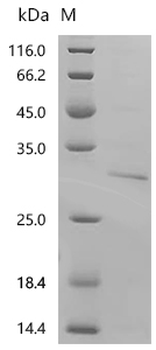 Recombinant Human GTPase KRas (KRAS) (G12C), partial