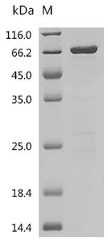 Recombinant Human GTPase KRas (KRAS) (G12C), partial, Biotinylated