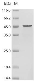 Recombinant Human Isovaleryl-CoA dehydrogenase, mitochondrial (IVD)
