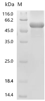 Recombinant Human Immunoglobulin superfamily containing leucine-rich repeat protein (ISLR)