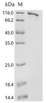 Recombinant Human Endoplasmin (HSP90B1)