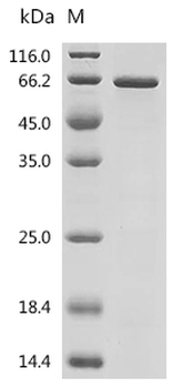 Recombinant Human Protein HEXIM1 (HEXIM1)