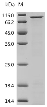 Recombinant Human Platelet glycoprotein Ib alpha chain (GP1BA), partial