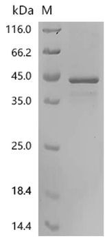 Recombinant Human GTP-binding protein GEM (GEM)