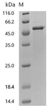 Recombinant Human Galactose-1-phosphate uridylyltransferase (GALT)