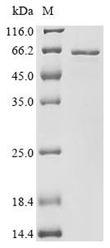 Recombinant Human Transcriptional regulator ERG (ERG)