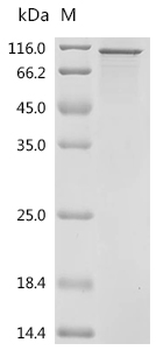 Recombinant Human Eukaryotic elongation factor 2 kinase (EEF2K)