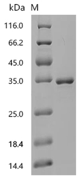 Recombinant Mouse Dystrophin (Dmd), partial