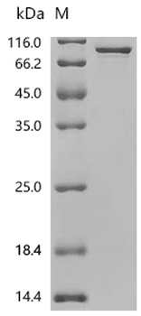 Recombinant Human ATP-dependent RNA helicase DDX3X (DDX3X)