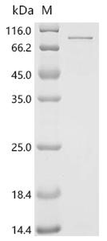 Recombinant Human ATP-dependent RNA helicase DDX3X (DDX3X)