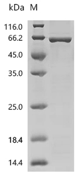 Recombinant Human Steroid 17-alpha-hydroxylase/17,20 lyase (CYP17A1)