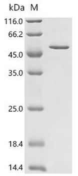 Recombinant Human CCAAT/enhancer-binding protein beta (CEBPB)