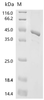 Recombinant Human G1/S-specific cyclin-D2 (CCND2)