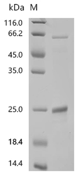 Recombinant Mouse Bone morphogenetic protein 15 (Bmp15)