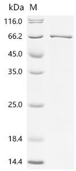 Recombinant Human RAC-alpha serine/threonine-protein kinase (AKT1)