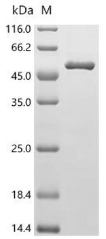 Recombinant Human Medium-chain specific acyl-CoA dehydrogenase, mitochondrial (ACADM)