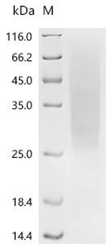 Recombinant Human Solute carrier organic anion transporter family member 1A2 (SLCO1A2),partial