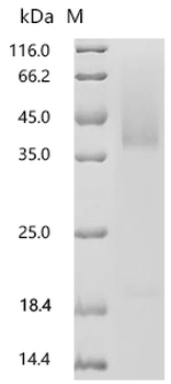 Recombinant Human Solute carrier organic anion transporter family member 1A2 (SLCO1A2),partial