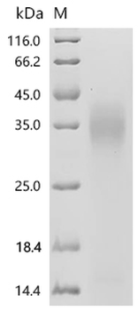 Recombinant Human Fos-related antigen 1 (FOSL1)
