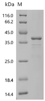 Recombinant Human Golgi-associated plant pathogenesis-related protein 1 (GLIPR2), partial