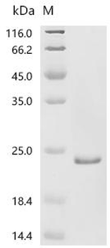 Recombinant Human RNA guanine-N7 methyltransferase activating subunit (RAMAC)