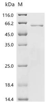 Recombinant Hantaan virus Nucleoprotein (N)