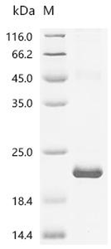 Recombinant Human Isoaspartyl peptidase/L-asparaginase (ASRGL1), partial