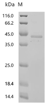 Recombinant Human Fos-related antigen 1 (FOSL1)