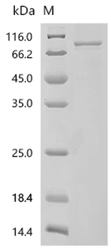 Recombinant Human Transient receptor potential cation channel subfamily V member 4 (TRPV4), partial