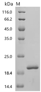 Recombinant Simian retrovirus SRV-1 Gag polyprotein (gag), partial