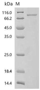 Recombinant Human Mini-chromosome maintenance complex-binding protein (MCMBP)