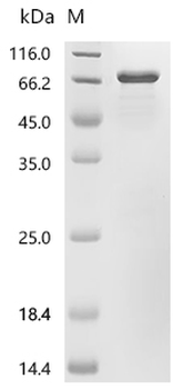 Recombinant Human F-box only protein 2 (FBXO2)