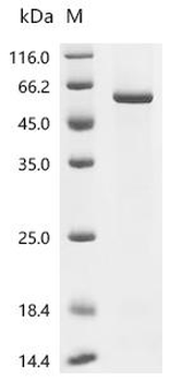 Recombinant Human Hyaluronidase PH-20 (SPAM1)