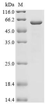 Recombinant Puumala virus Nucleoprotein (N)