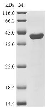 Recombinant Human DNA repair endonuclease XPF (ERCC4), partial