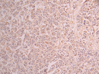 ST13 Antibody