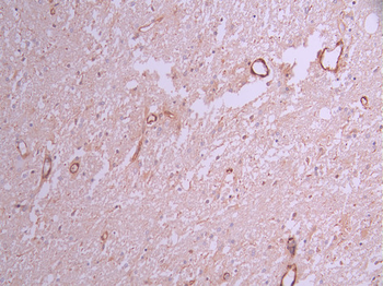 ACTA2 Antibody