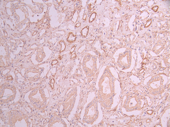 ACTA2 Antibody